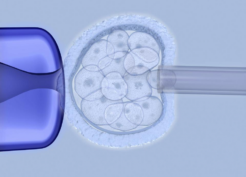 Embryo screening can improve pregnancy rate by 73 % expert says